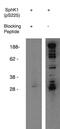 Sphingosine Kinase 1 antibody, MBS395609, MyBioSource, Western Blot image 