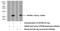 Kinesin Family Member 26B antibody, 17422-1-AP, Proteintech Group, Western Blot image 