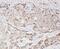 WAP Four-Disulfide Core Domain 1 antibody, FNab09507, FineTest, Immunohistochemistry paraffin image 