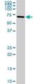 Arachidonate 15-Lipoxygenase antibody, H00000246-D01P, Novus Biologicals, Western Blot image 