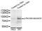 Protein Kinase C Theta antibody, STJ113501, St John