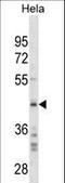 SPARC antibody, LS-C156115, Lifespan Biosciences, Western Blot image 