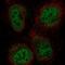 Zinc Finger And BTB Domain Containing 47 antibody, NBP2-56064, Novus Biologicals, Immunocytochemistry image 