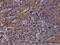 Sorting Nexin 1 antibody, H00006642-M01, Novus Biologicals, Immunohistochemistry frozen image 