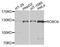 Roundabout Guidance Receptor 4 antibody, A9876, ABclonal Technology, Western Blot image 