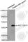 AKT Serine/Threonine Kinase 2 antibody, AP0305, ABclonal Technology, Western Blot image 