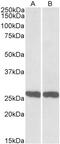 NLR Family Member X1 antibody, 42-794, ProSci, Western Blot image 