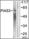 Protein Inhibitor Of Activated STAT 3 antibody, orb96010, Biorbyt, Western Blot image 