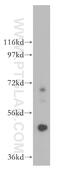 Carboxypeptidase A5 antibody, 13731-1-AP, Proteintech Group, Western Blot image 