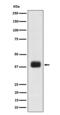 Serine/arginine-rich splicing factor 6 antibody, M04489, Boster Biological Technology, Western Blot image 