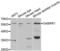 Gamma-Aminobutyric Acid Type A Receptor Rho1 Subunit antibody, abx004395, Abbexa, Western Blot image 