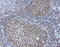 Myocyte Enhancer Factor 2C antibody, LS-C796682, Lifespan Biosciences, Immunohistochemistry paraffin image 