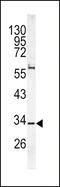 Calcium Voltage-Gated Channel Auxiliary Subunit Gamma 5 antibody, MBS9211306, MyBioSource, Western Blot image 