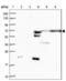 Ankyrin Repeat Domain 55 antibody, NBP2-14719, Novus Biologicals, Western Blot image 