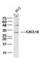C-X-C Motif Chemokine Ligand 16 antibody, GTX60199, GeneTex, Western Blot image 