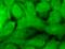 Gamma-Aminobutyric Acid Type A Receptor Beta1 Subunit antibody, SMC-340D-P594, StressMarq, Immunofluorescence image 