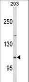 Espin antibody, LS-C167826, Lifespan Biosciences, Western Blot image 