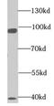 EMAP Like 1 antibody, FNab02756, FineTest, Western Blot image 