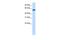 Zinc Finger Protein 394 antibody, PA5-40322, Invitrogen Antibodies, Western Blot image 