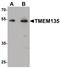 Transmembrane Protein 135 antibody, PA5-34535, Invitrogen Antibodies, Western Blot image 