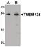 Transmembrane Protein 135 antibody, PA5-34535, Invitrogen Antibodies, Western Blot image 