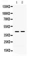 Meis Homeobox 1 antibody, PB9810, Boster Biological Technology, Western Blot image 
