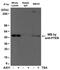 Acetyl Lysine antibody, NBP2-77397, Novus Biologicals, Immunoprecipitation image 