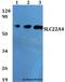 Solute Carrier Family 22 Member 4 antibody, A03032, Boster Biological Technology, Western Blot image 