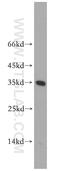 Activator Of Basal Transcription 1 antibody, 14148-1-AP, Proteintech Group, Western Blot image 