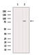 PARP2 antibody, GTX01558, GeneTex, Western Blot image 