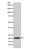 CD3g Molecule antibody, M04853-1, Boster Biological Technology, Western Blot image 