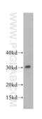 SRP Receptor Subunit Beta antibody, 14636-1-AP, Proteintech Group, Western Blot image 