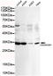 Cyclin Dependent Kinase 1 antibody, STJ99114, St John