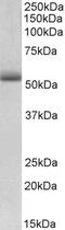 Electron Transfer Flavoprotein Subunit Alpha antibody, 42-619, ProSci, Immunohistochemistry frozen image 