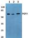 DEAQ-Box RNA Dependent ATPase 1 antibody, A16175-1, Boster Biological Technology, Western Blot image 