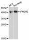 Interferon Gamma Receptor 2 antibody, STJ24134, St John