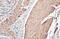 Actin Alpha 2, Smooth Muscle antibody, GTX636885, GeneTex, Immunohistochemistry paraffin image 