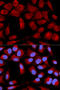 Pyruvate Dehydrogenase E1 Alpha 1 Subunit antibody, 15-043, ProSci, Immunofluorescence image 