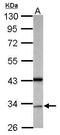 Growth Arrest Specific 2 Like 1 antibody, PA5-21729, Invitrogen Antibodies, Western Blot image 