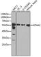 Karyopherin Subunit Alpha 2 antibody, GTX54349, GeneTex, Western Blot image 