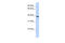 TRIM27 antibody, 31-274, ProSci, Enzyme Linked Immunosorbent Assay image 