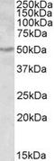 Aldehyde Dehydrogenase 9 Family Member A1 antibody, LS-B9218, Lifespan Biosciences, Western Blot image 