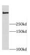 Dynein Cytoplasmic 1 Heavy Chain 1 antibody, FNab02582, FineTest, Western Blot image 