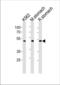 Bleomycin Hydrolase antibody, TA328161, Origene, Western Blot image 