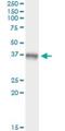 Mitogen-Activated Protein Kinase Kinase 3 antibody, H00005606-M02, Novus Biologicals, Immunoprecipitation image 