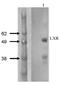 Nuclear Receptor Subfamily 1 Group H Member 3 antibody, ab3585, Abcam, Western Blot image 