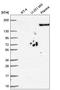 Plexin A3 antibody, HPA058989, Atlas Antibodies, Western Blot image 