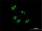 Treacher Collins syndrome protein antibody, H00006949-M02, Novus Biologicals, Immunofluorescence image 