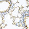 Eotaxin-1 antibody, LS-C409169, Lifespan Biosciences, Immunohistochemistry paraffin image 