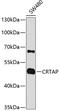 Cartilage Associated Protein antibody, 19-366, ProSci, Western Blot image 